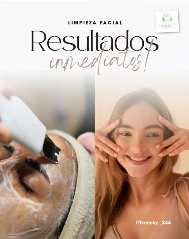 Publicación de Ivensky sobre limpieza facial